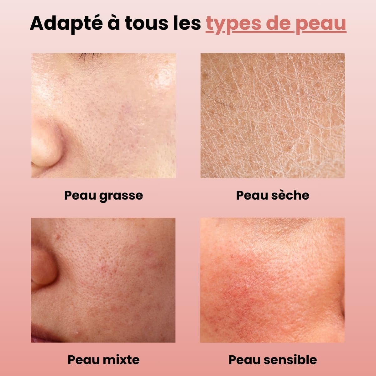 Soin Haute Fréquence - Belle saison ®