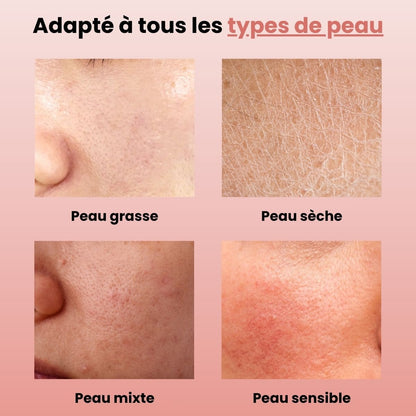 Soin Haute Fréquence - Belle saison ®