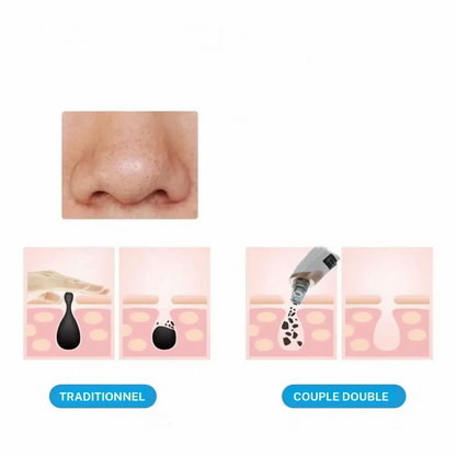 Aspirateur à point noir